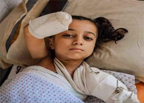 مفوض الأونروا: غزة الآن موطن لأكبر عدد من الأطفال مبتوري الأطراف في العالم