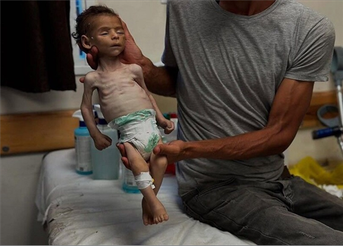 الأونروا: البقاء على قيد الحياة في غزة أصبح شبه معجزة